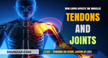Understanding Lupus: Its Impact on Muscles, Tendons, and Joints