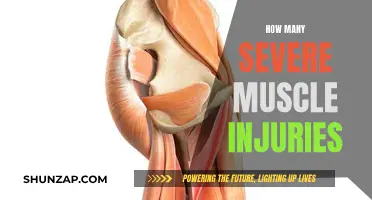 Muscle Tears: Counting the Severe Injuries