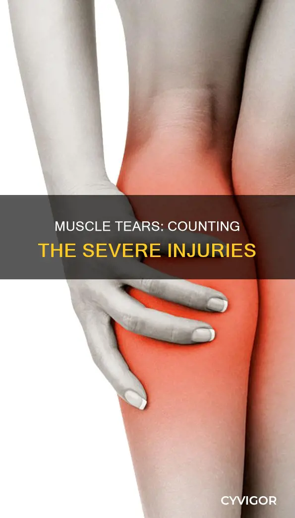 how many severe muscle injuries