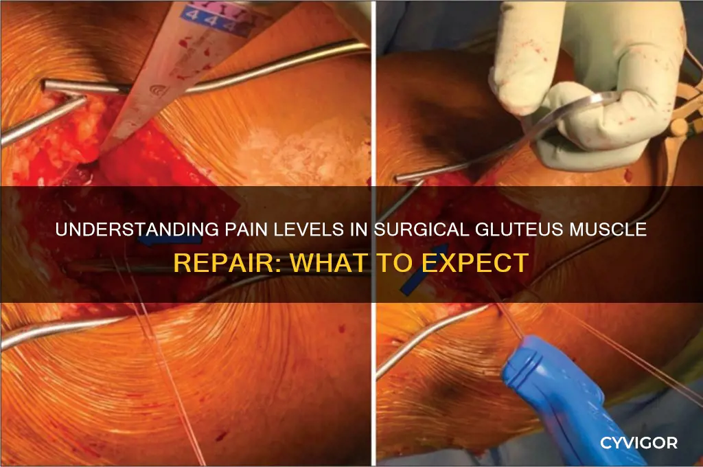 how much pain is associated glteous muscle repair surgically
