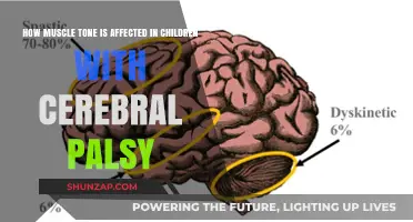 Understanding Cerebral Palsy's Impact on Children's Muscle Tone