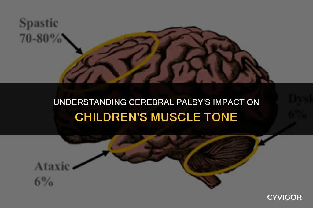 how muscle tone is affected in children with cerebral palsy
