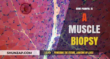 Muscle Biopsy Pain: What to Expect During and After the Procedure