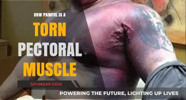 Torn Pectoral Muscle Pain: Severity, Symptoms, and Recovery Insights