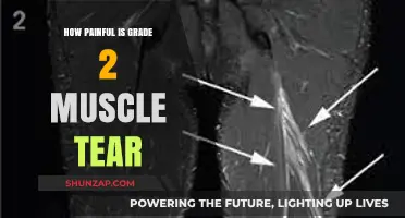 Understanding the Pain and Recovery of a Grade 2 Muscle Tear