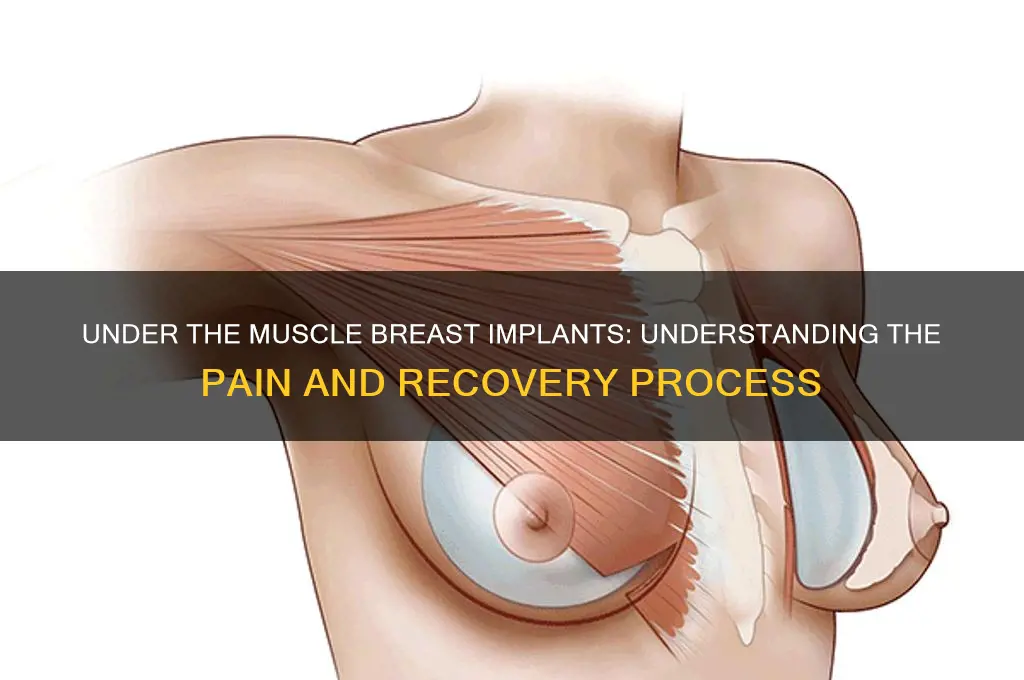 how painful is under the muscle breat implants