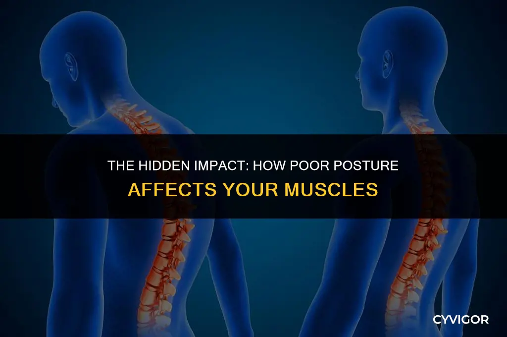 how poor posture affects muscles