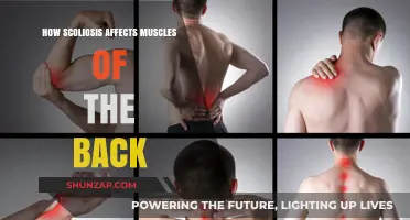 Understanding Scoliosis: Impact on Back Muscles and Treatment Options
