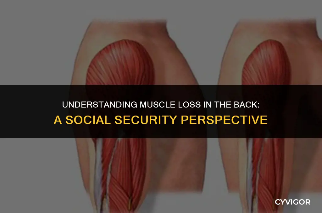 how soc sec views muscle loss in back