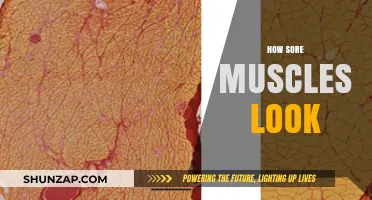 Unveiling the Appearance of Sore Muscles: What Happens Beneath the Surface