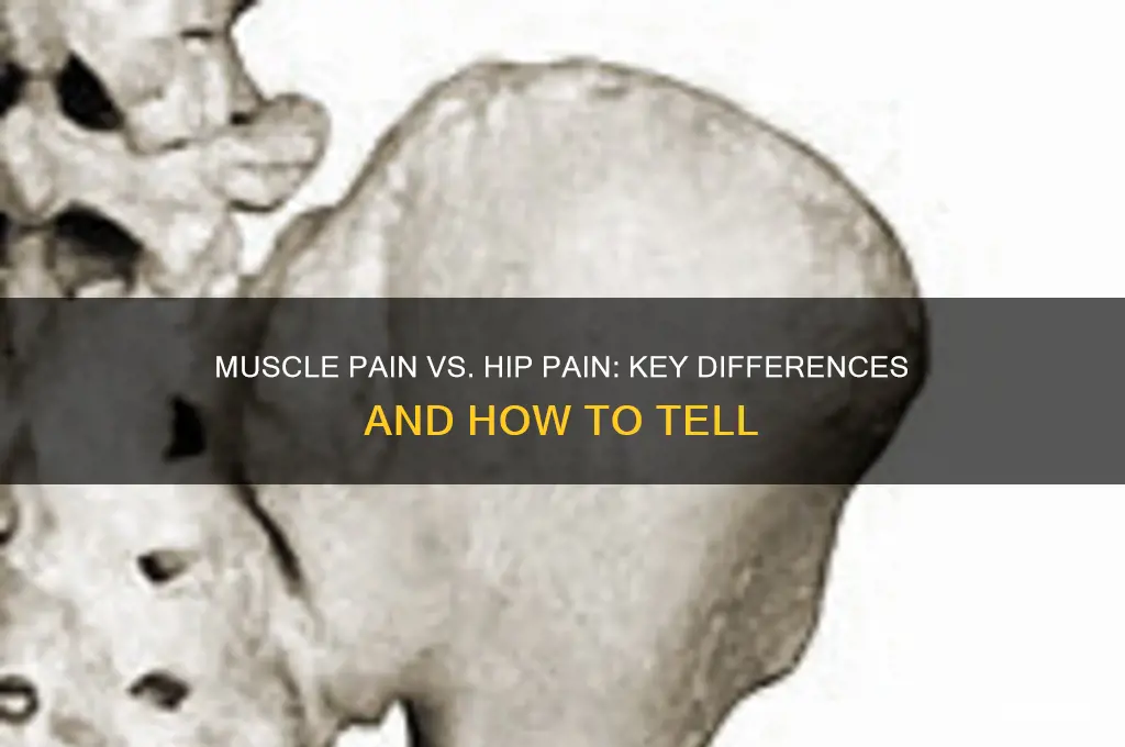 how tell difference muscle pain hip pain