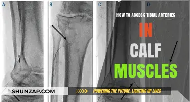 Unlocking the Pathways: A Guide to Accessing Tibial Arteries in Calf Muscles