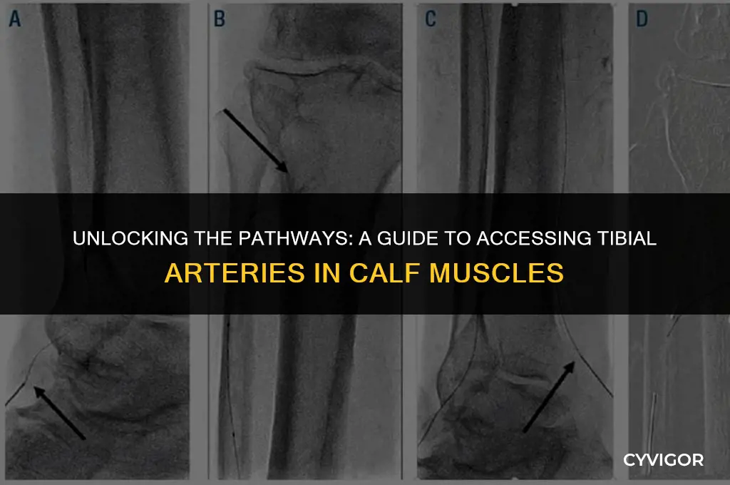 how to access tibial arteries in calf muscles