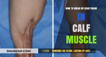 Effective Ways to Break Up Scar Tissue in Your Calf Muscle