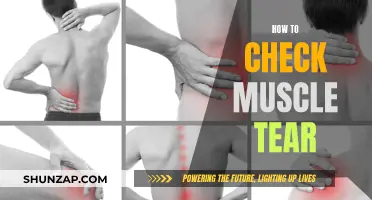 Muscle Tears: Identifying and Treating Them