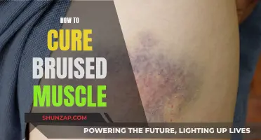 Effective Treatments for Bruised Muscles
