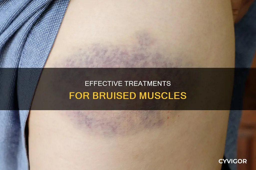 how to cure bruised muscle