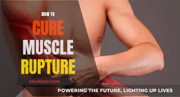 Healing Muscle Rupture: Effective Strategies for Recovery