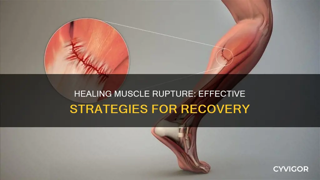 how to cure muscle rupture