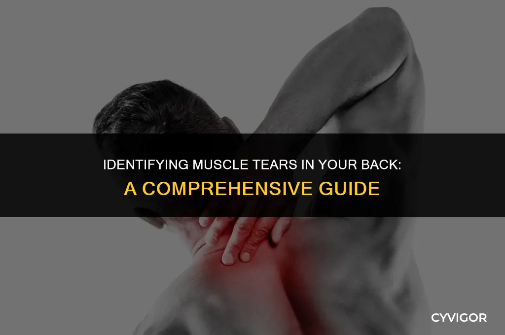 how to detect a muscle tear in back