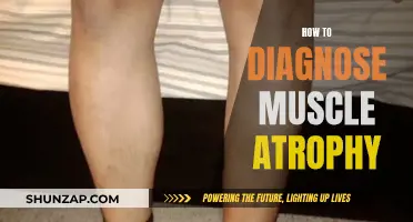 Diagnosing Muscle Atrophy: What You Need to Know