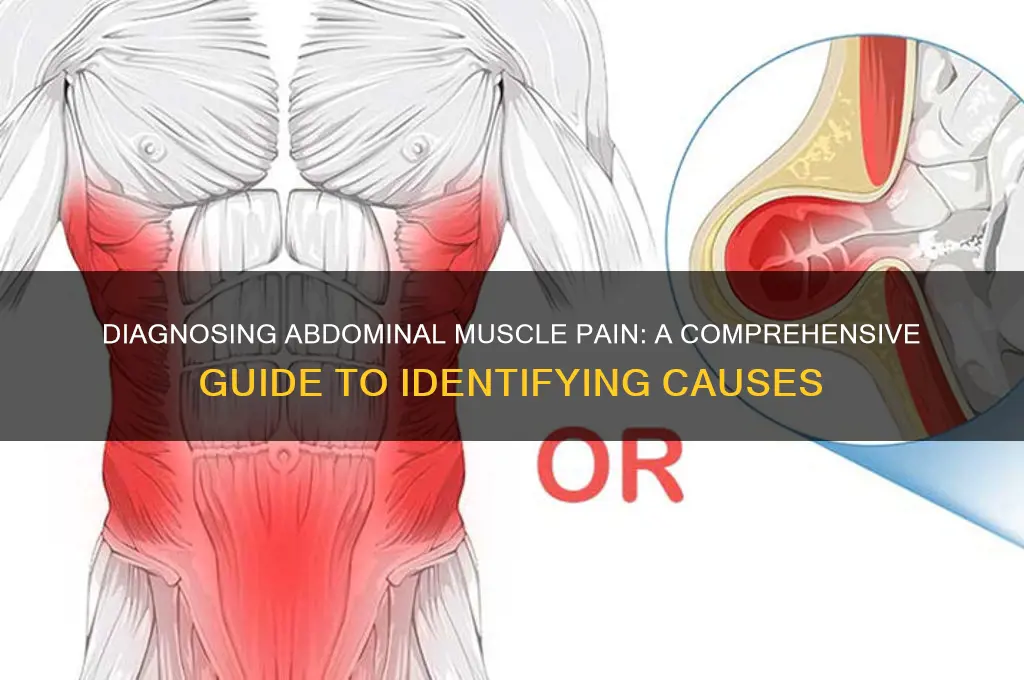 how to diagnose muscle pain in abdomen