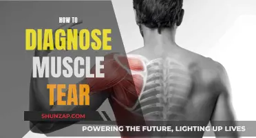 Diagnosing Muscle Tears: What You Need to Know