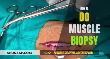 Muscle Biopsy: A Step-by-Step Guide for Medical Professionals