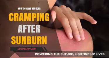 Soothing Sunburn: Effective Remedies for Muscle Cramps Relief