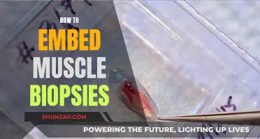 Muscle Biopsies: Embedding Techniques for Optimal Results