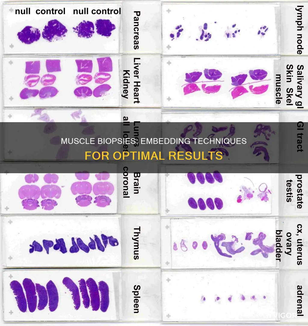 how to embed muscle biopsies