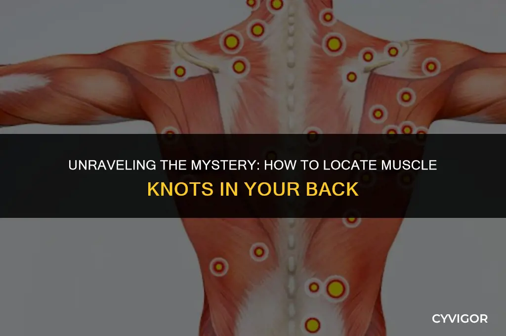how to find source of muscle knots in the back