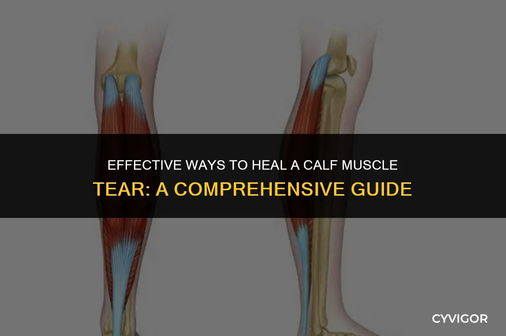 how to fix a calf muscle tear