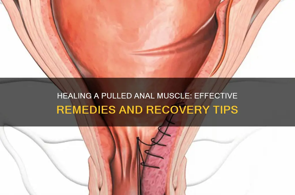 how to fix a pulled muscle in your asshole