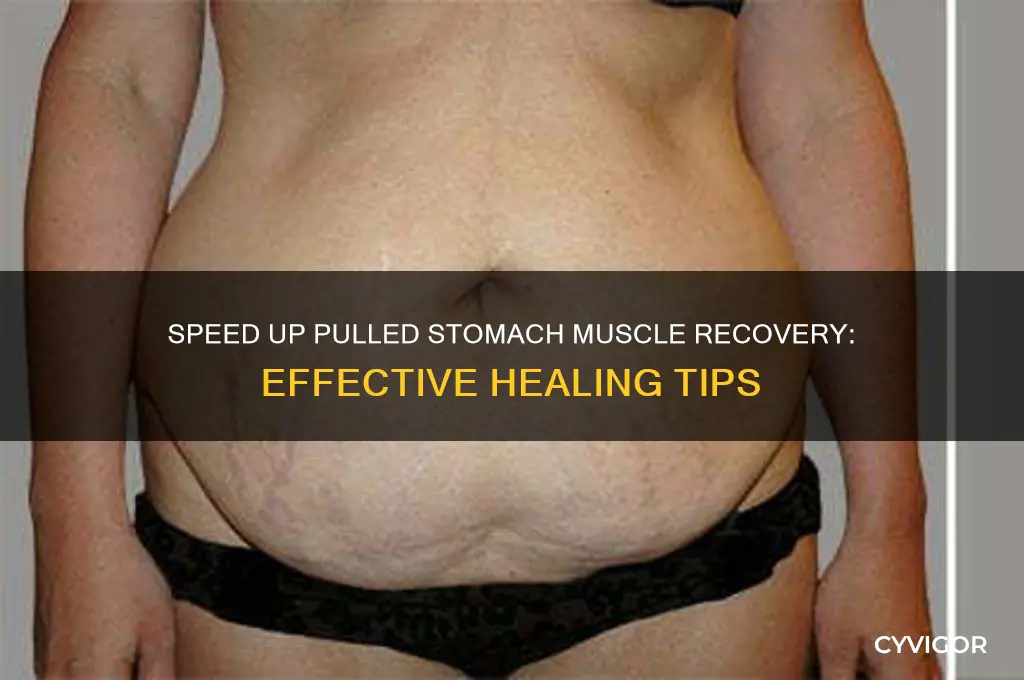 how to get a pulled stomach muscle heal faster