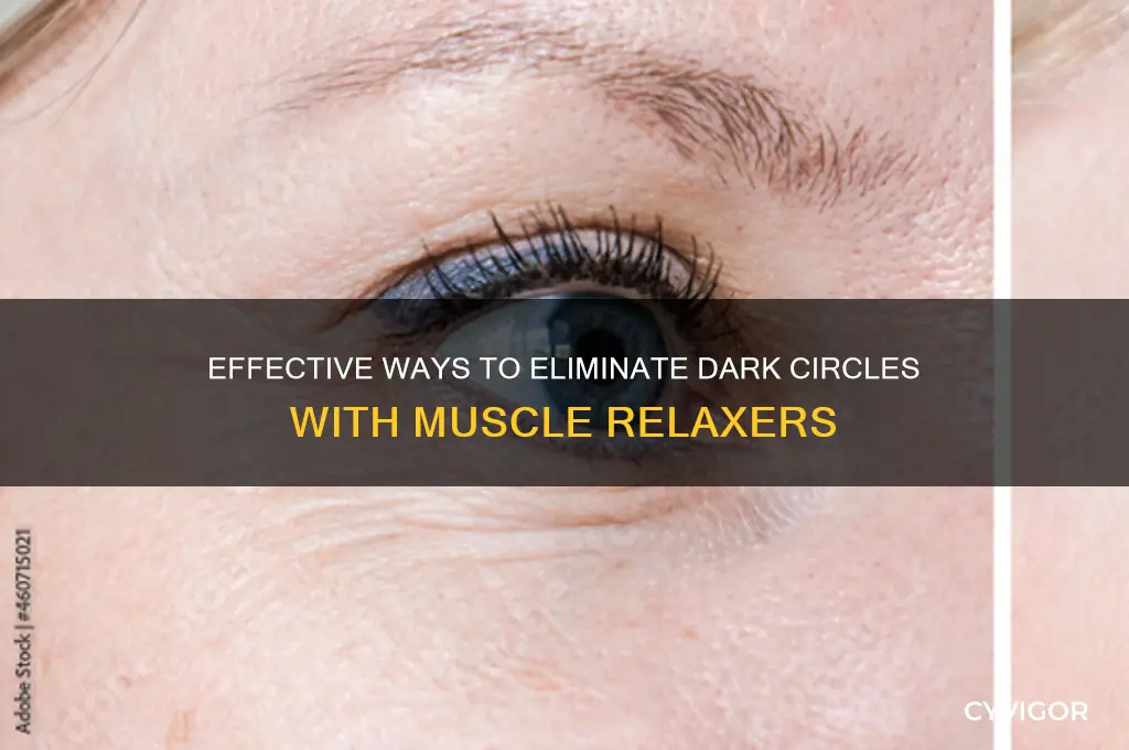 how to get rid of black circles muscle relaxers