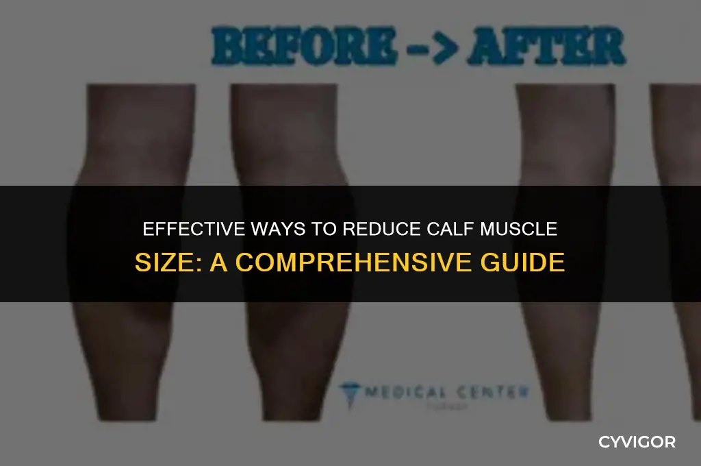 how to get rid of calf muscle