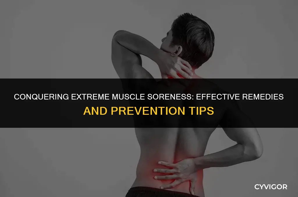 how to get rid of extreme muscle soreness