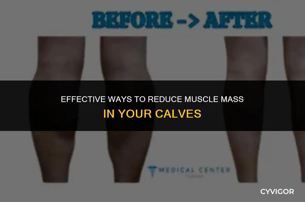 how to get rid of muscle in calves