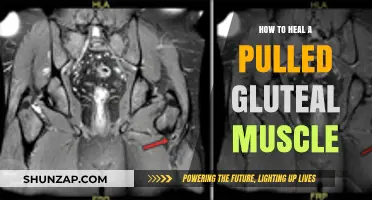 Effective Healing Strategies for Pulled Gluteal Muscles: A Comprehensive Guide