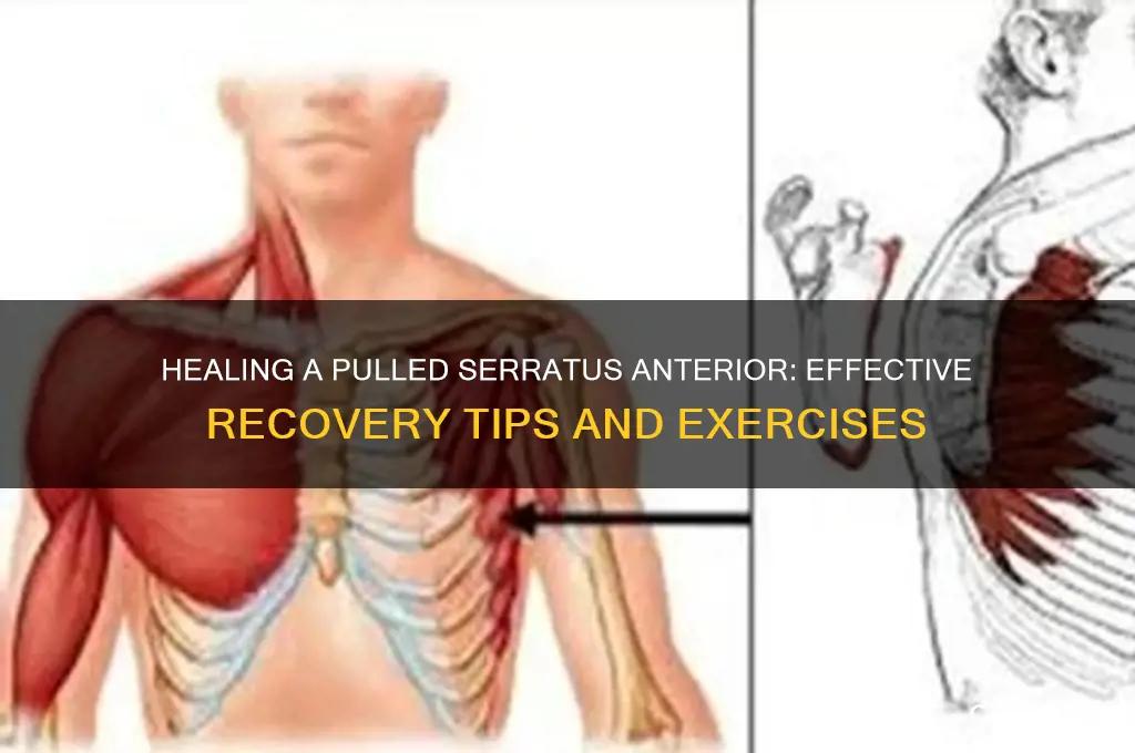 how to heal a pulled serratus anterior muscle