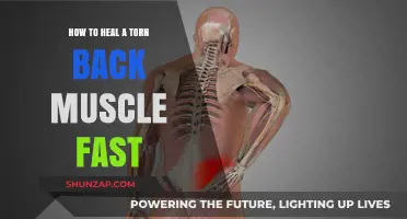 Speedy Recovery: Effective Tips to Heal a Torn Back Muscle