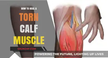 Effective Ways to Heal a Torn Calf Muscle: A Comprehensive Guide