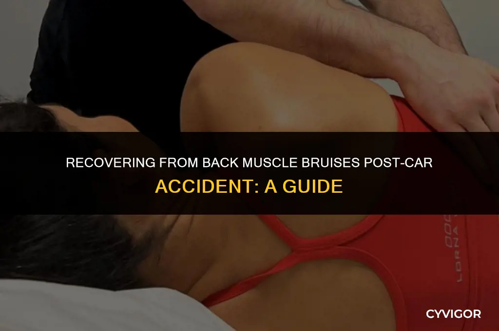 how to heal bruised back muscles after car accident