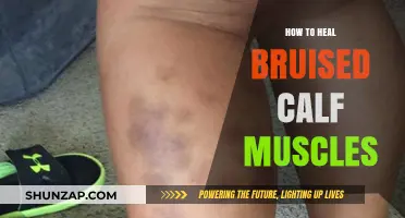 Effective Ways to Heal and Recover from Bruised Calf Muscles
