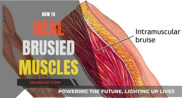 Healing Bruised Muscles: Effective Strategies for Quick Recovery