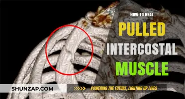Effective Healing Strategies for Pulled Intercostal Muscles: A Comprehensive Guide