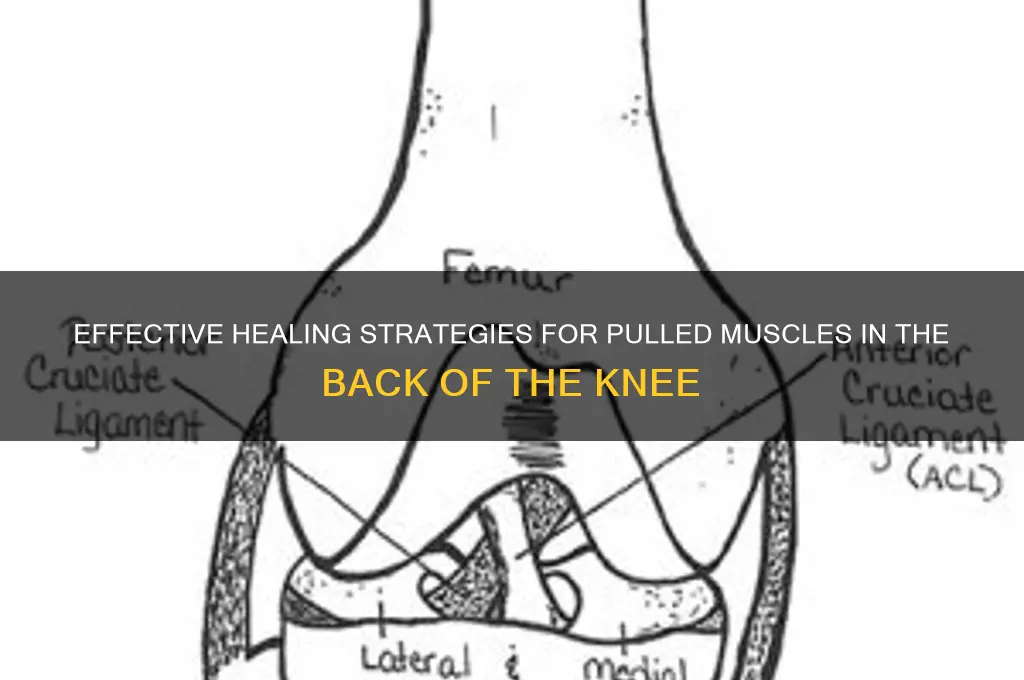 how to heal pulled muscle in back of knee