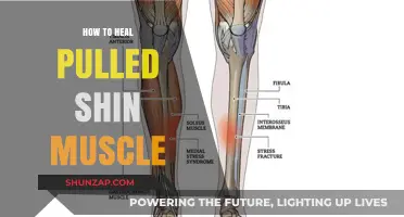 Effective Healing Strategies for Pulled Shin Muscles: A Comprehensive Guide