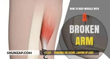 Maintaining Muscle Strength While Healing from a Broken Arm